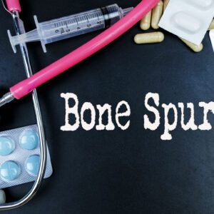 Bone Spurs &#8211; Causes, Types, and Management Options