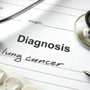 Lung Cancer &#8211; Types, Causes, and Symptoms