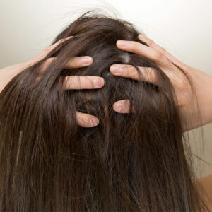 Top 5 Products to Combat Hair Loss