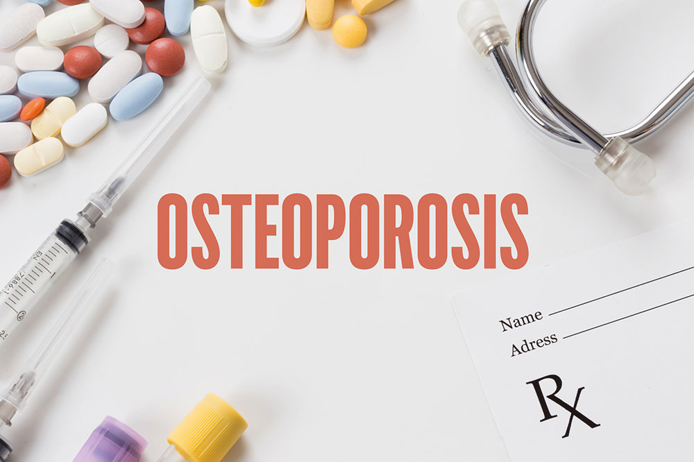 Things to Know About Osteoporosis Management