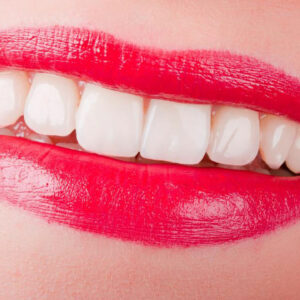 4 useful tips for sparkling pearly white teeth