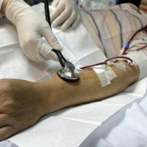 5 useful things a person undergoing kidney dialysis should know