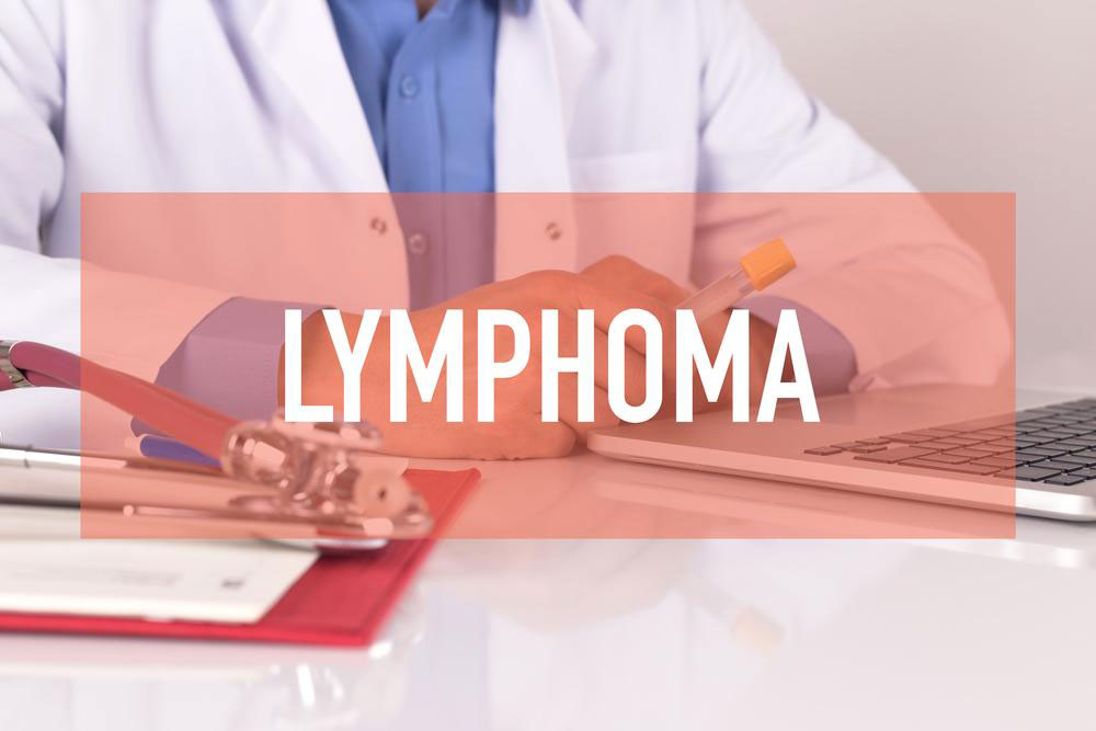 Non Hodgkin Lymphoma treatment &#8211; Symptoms, causes and more explained