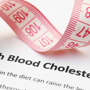 Symptoms, causes, and risks of high cholesterol