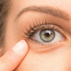 10 Tips to Remove Under-Eye Bags