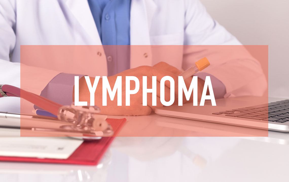 Common Causes, Risk Factors, and Symptoms of Lymphoma