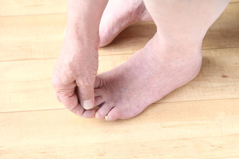 A Complete Guide to Diabetic Feet Care