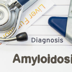 Everything About the Different Types of Amyloidosis