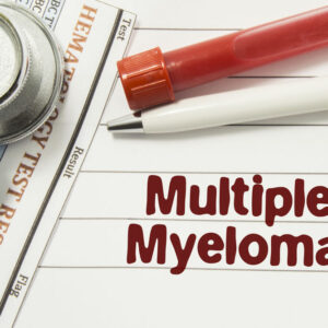 Top 3 foods for multiple myeloma symptoms